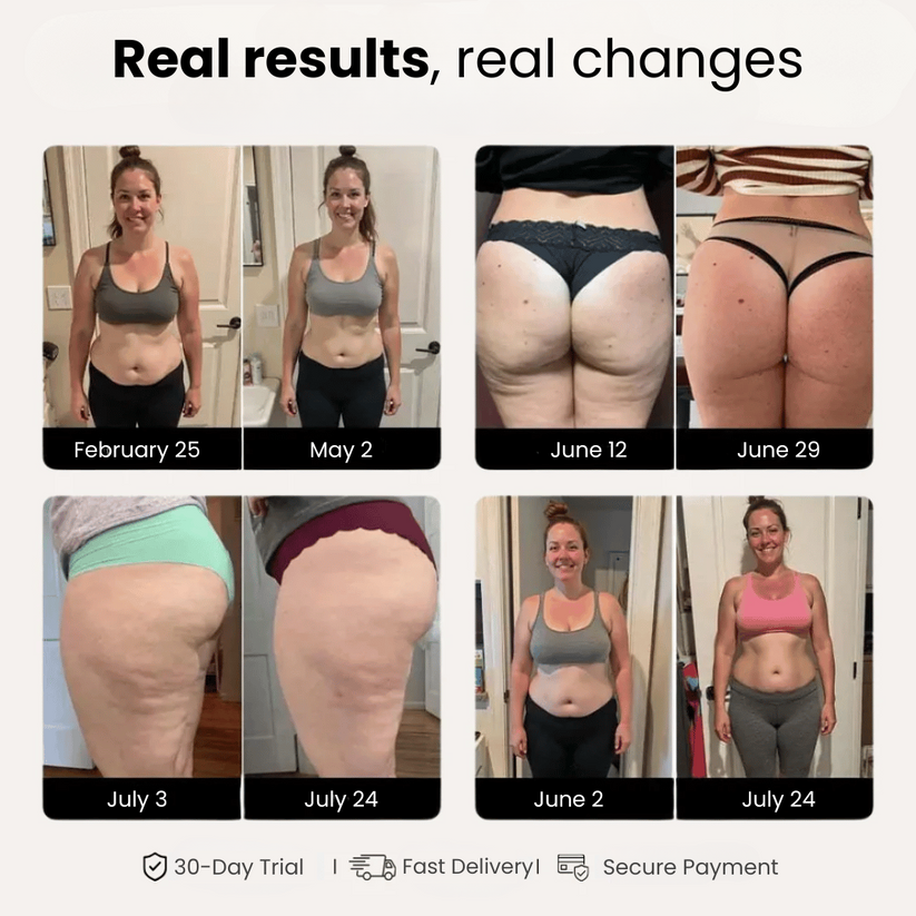 Empiriya 4D Sculpting Leggings - Advanced Cellulite Reduction & Weight Loss